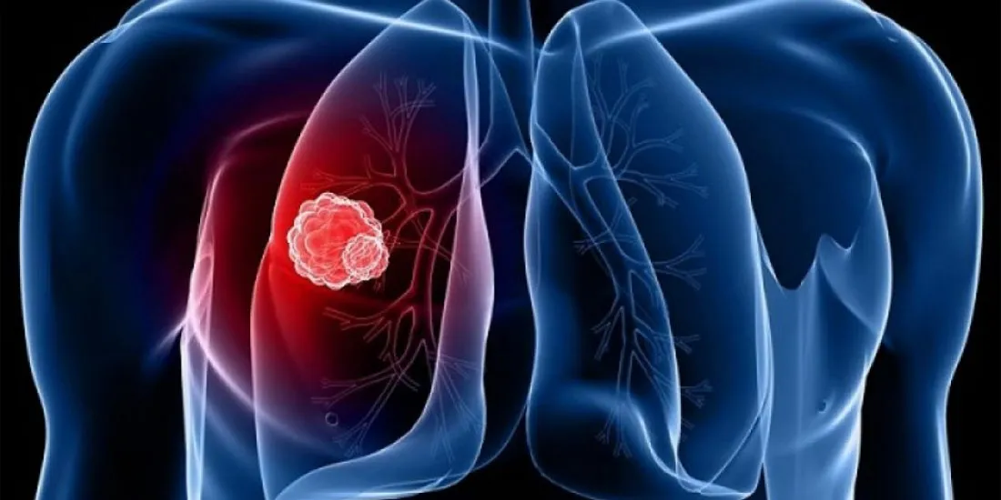 Καινοτόμες Ανοσοθεραπείες: Ποιο το όφελος για την κοινωνία