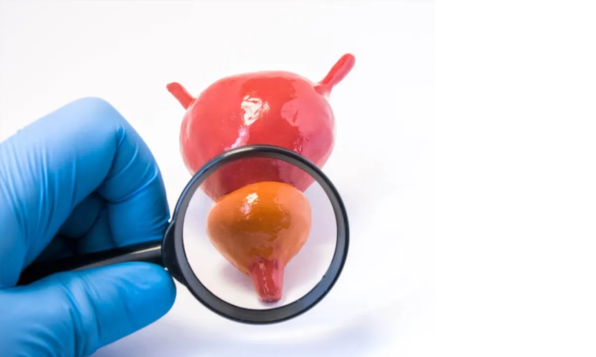 Καρκίνος Προστάτη: Fusion βιοψία και ρομποτική προστατεκτομή