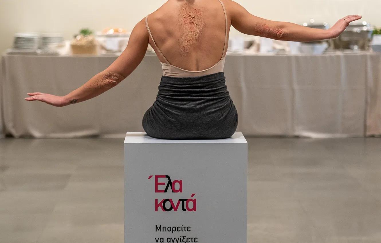 Από την ηλικία των 30 ετών ξεκινούν οι συννοσηρότητες στους ασθενείς με ψωρίαση