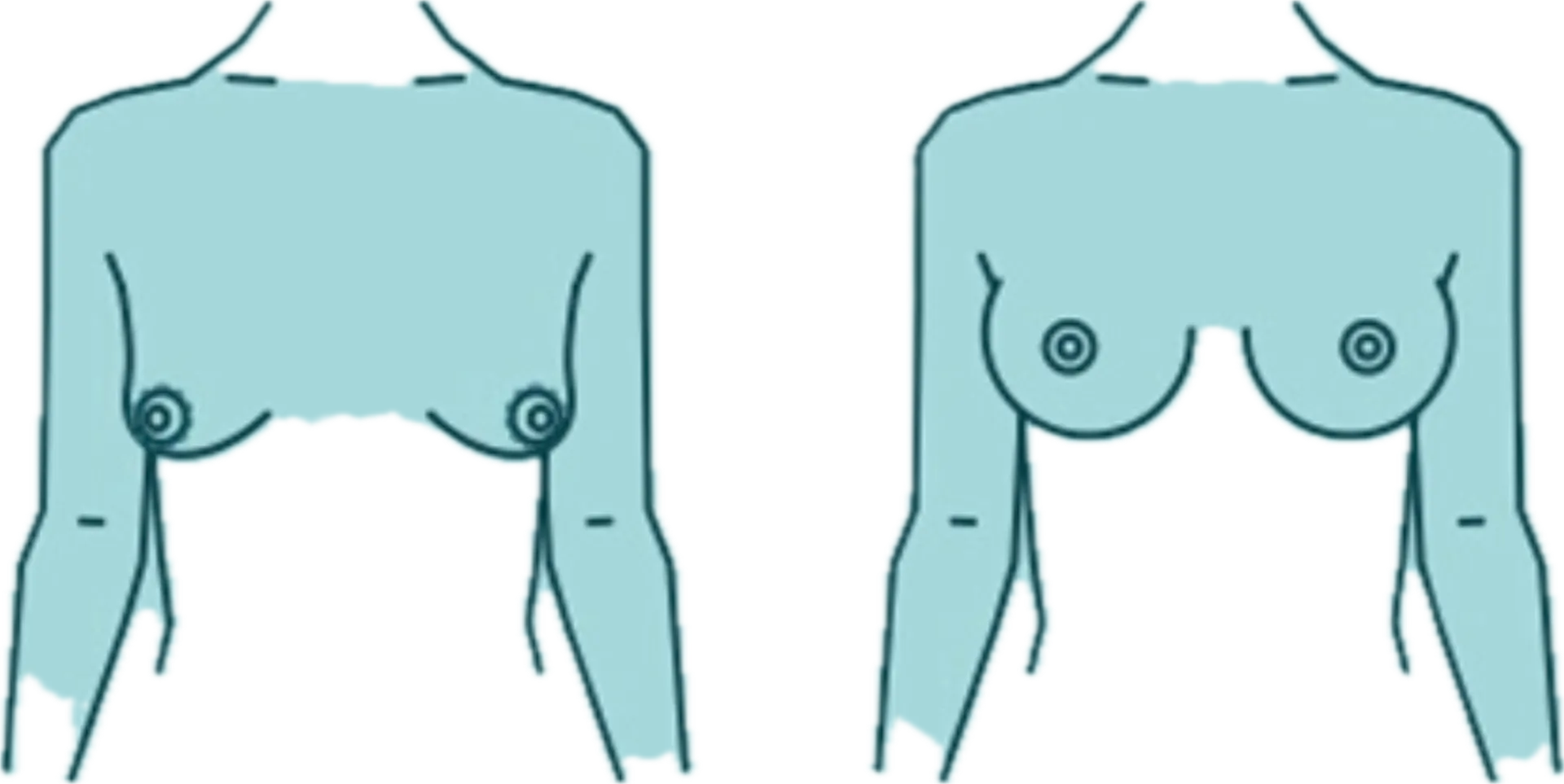 Σύγχρονη ακτινοθεραπευτική αντιμετώπιση ογκολογικών περιστατικών