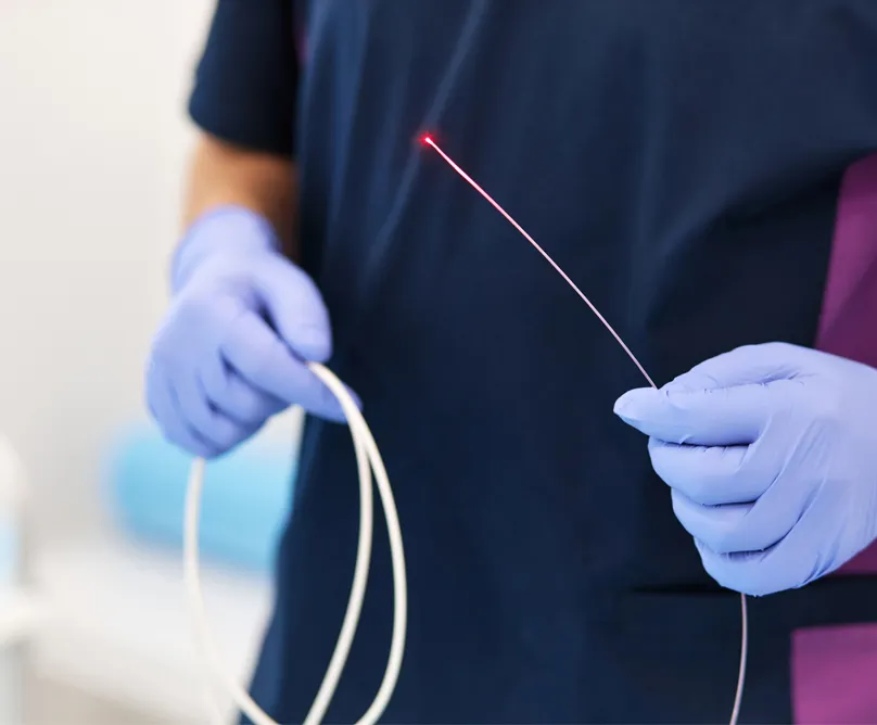 Ενδοαυλική θεραπεία με laser: Αντιμετώπιση κιρσών και φλεβικής ανεπάρκειας