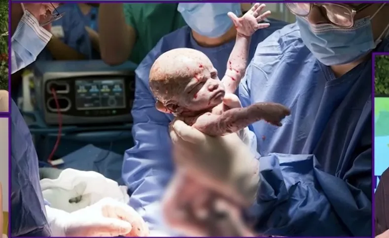 Με ελληνικό «άρωμα» οι μεταμοσχεύσεις μήτρας, από τις οποίες έχουν γεννηθεί 5 παιδιά σε 11 χρόνια