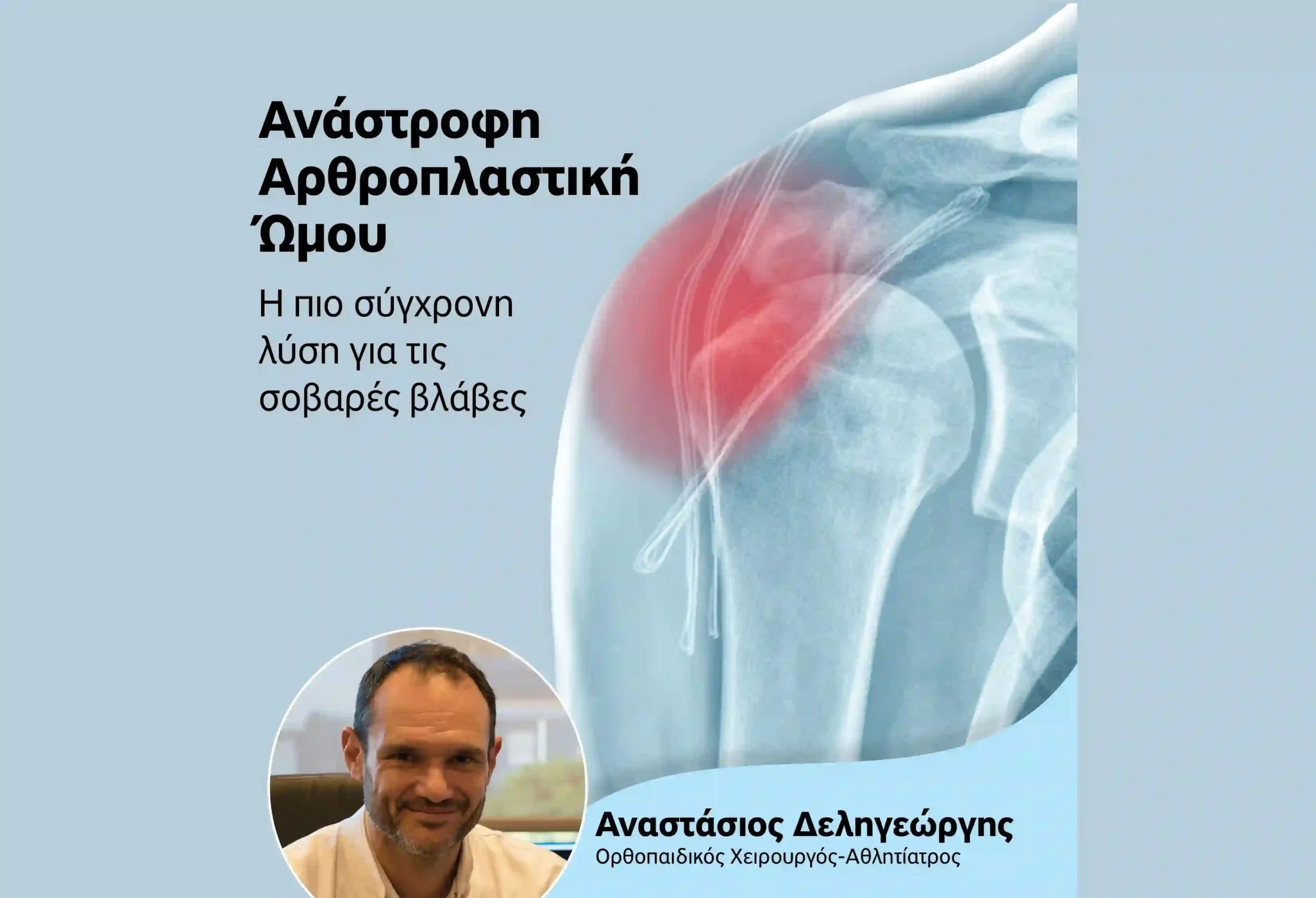 Ανάστροφη Αρθροπλαστική Ώμου: Σύγχρονη λύση για πολύπλοκα προβλήματα