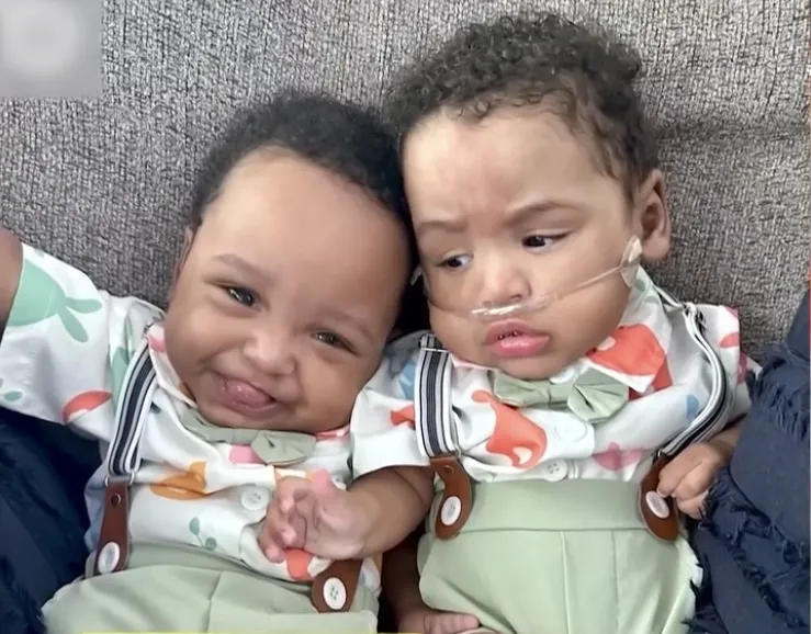 Μπήκαν στο βιβλίο των ρεκόρ Γκίνες τα πιο πρόωρα 4τραδυμα