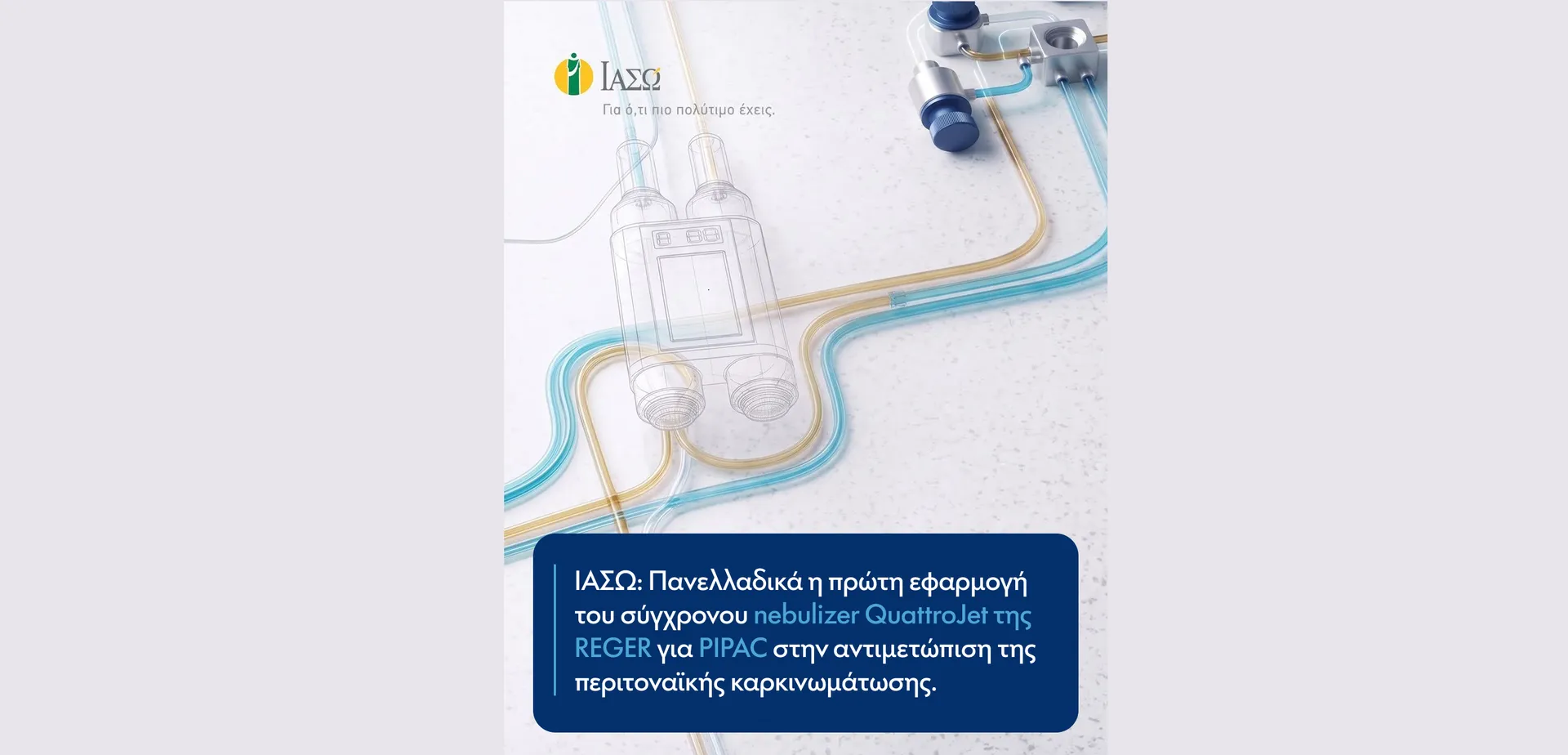ΙΑΣΩ: Πανελλαδικά η πρώτη εφαρμογή του σύγχρονου nebulizer "QuattroJet" 